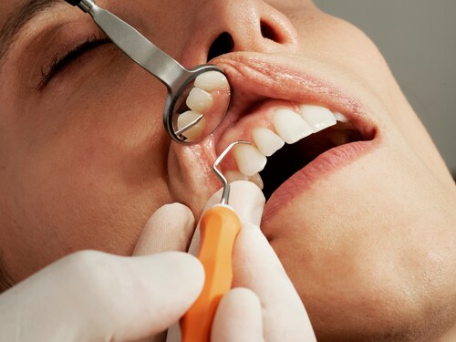 What to Consider When Choosing a Dental Clinic for the Family